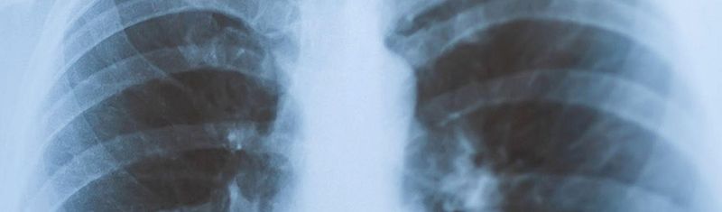 Stylized image resembling an X-ray or CT scan of lungs