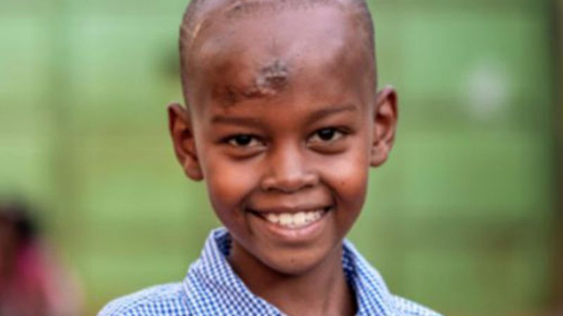 Portrait of Stephan, a young Kenyan boy with hemophilia, smiling and wearing a blue and white checkered shirt