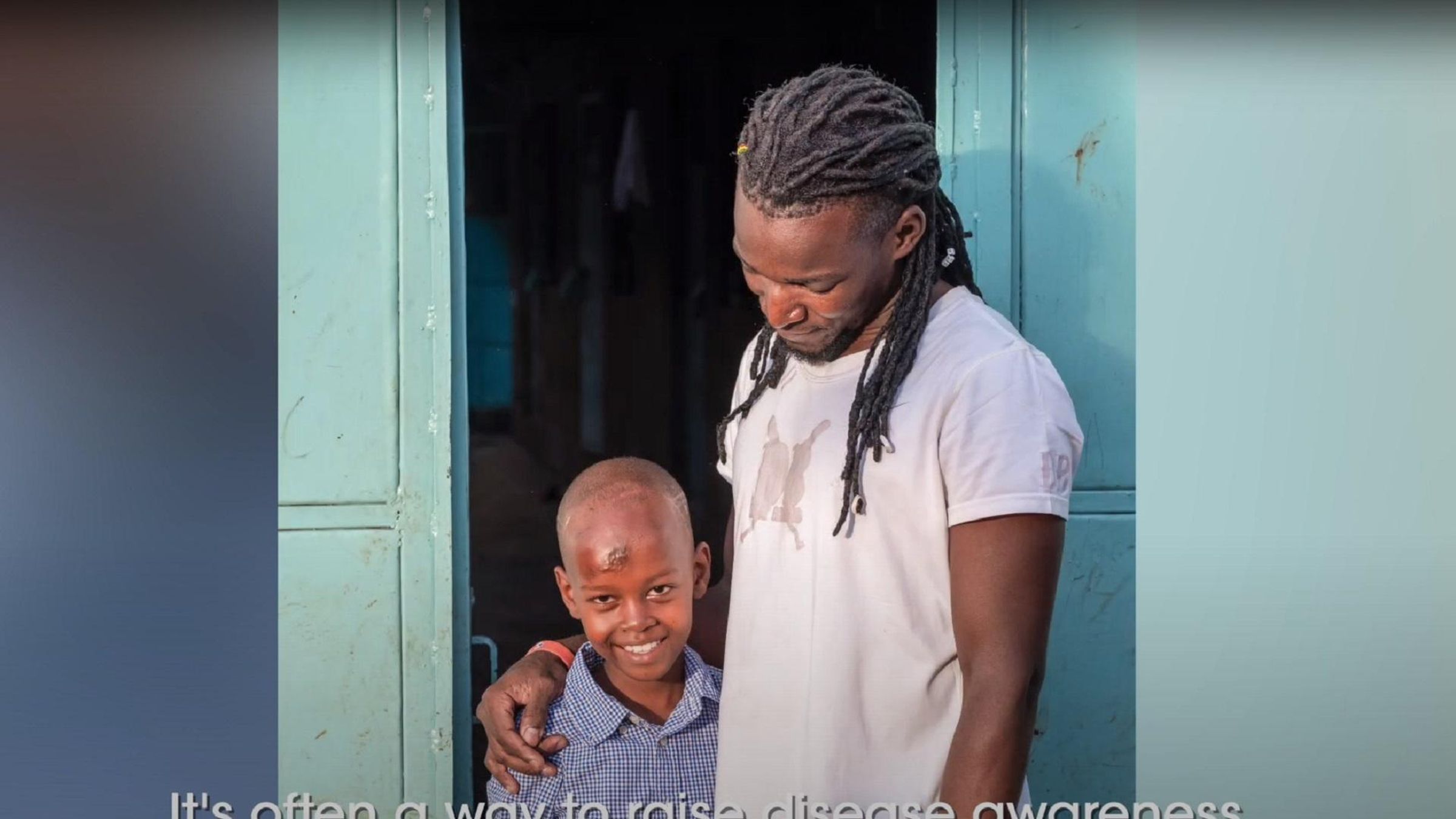 Man with dreadlocks in a white t-shirt and young boy in a checkered shirt with a forehead scar, smiling together in front of a green door